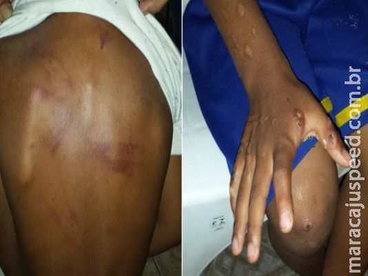 Mãe presa por tortura diz que agrediu menino ao vê-lo sofrendo tentativa de estupro