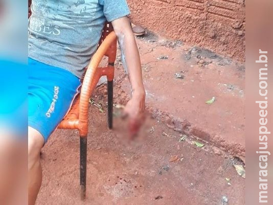 Menino perde os dedos em explosão de granada da polícia após conflito