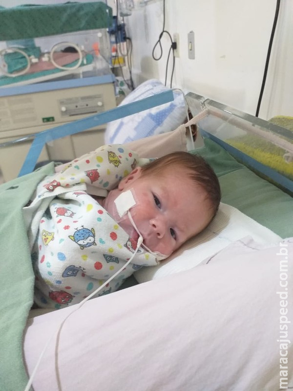Bebê com tumor que teve equipe médica de 50 pessoas no parto recebe alta médica após 41 dias 