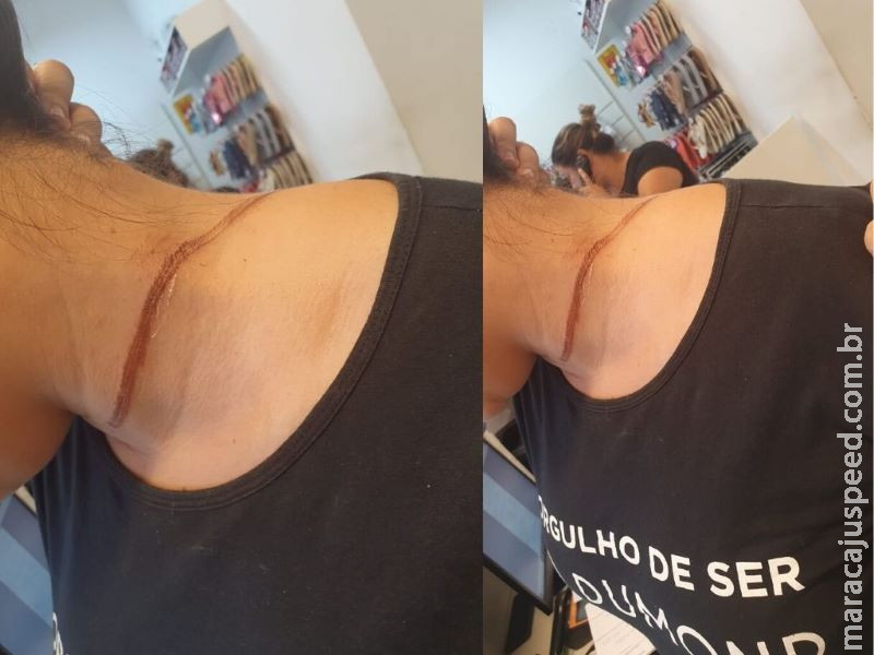 Motociclista esbarra em fio solto na rua, cai e se machuca em Aquidauana