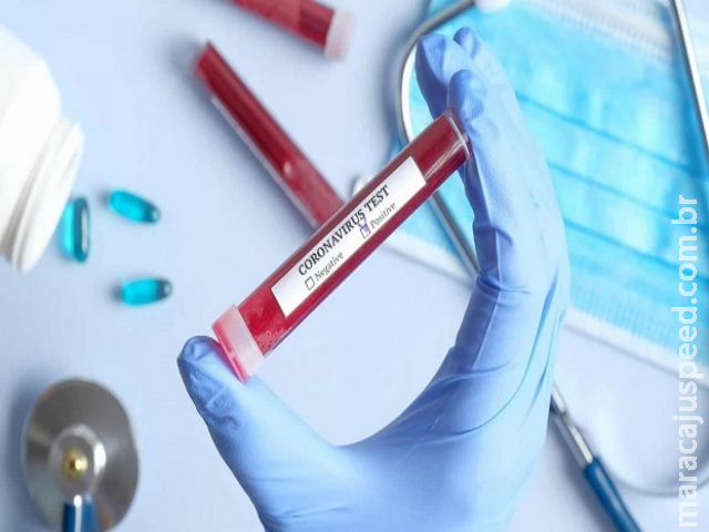 Sobe para 168 o número de casos confirmados de coronavírus e outros 43 casos suspeitos são monitorado no MS. Maracaju não possui caso suspeito e nenhum caso confirmado segundo boletim epidemiológico Sobe para 168 o número de casos confirmados de coronavírus e outros 43 casos suspeitos são monitorado no MS. Maracaju não possui caso suspeito e nenhum caso confirmado segundo boletim epidemiológico