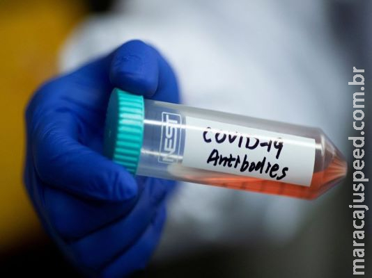 Pesquisa testa em voluntários medicamento para tratar a Covid-19 Pesquisa testa em voluntários medicamento para tratar a Covid-19