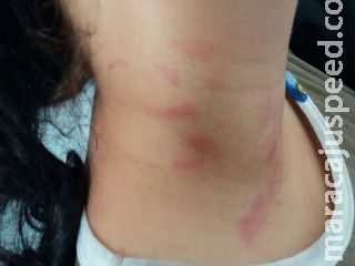 Grávida é agredida por amante do marido ao ver os dois na cama em Campo Grande Grávida é agredida por amante do marido ao ver os dois na cama em Campo Grande