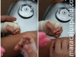 Mãe é acusada de queimar mãos de criança que abriu geladeira para pegar Toddynho