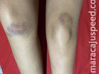 Médico é afastado de hospital após ser preso e acusado de espancar namorada em MS Médico é afastado de hospital após ser preso e acusado de espancar namorada em MS