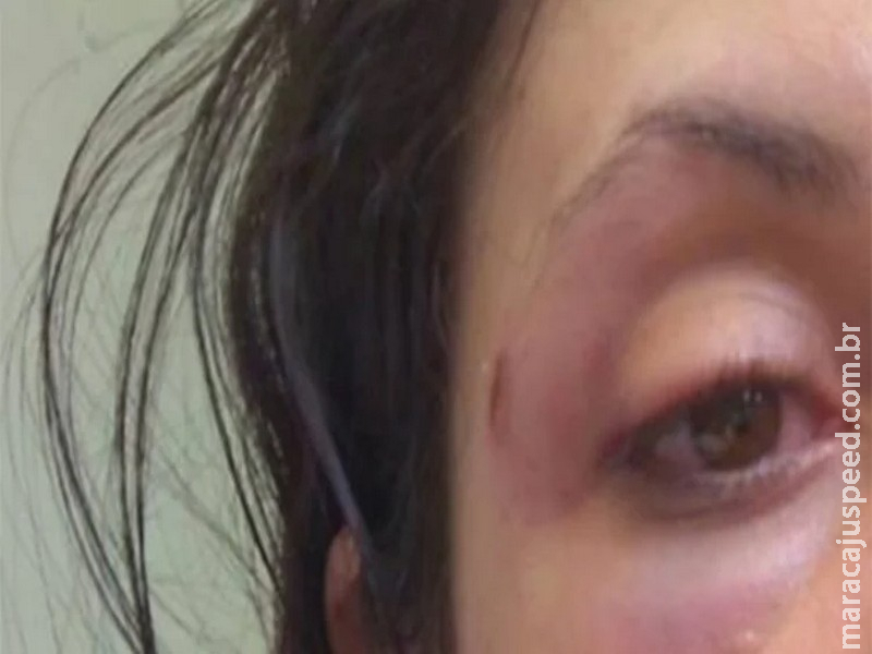 Após ser espancada por três horas pelo marido, mulher foge e ele é preso em MS Após ser espancada por três horas pelo marido, mulher foge e ele é preso em MS