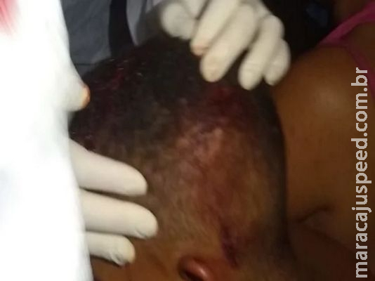 Nora tenta esfaquear homem e acaba agredida com barra de ferro por vizinho Nora tenta esfaquear homem e acaba agredida com barra de ferro por vizinho
