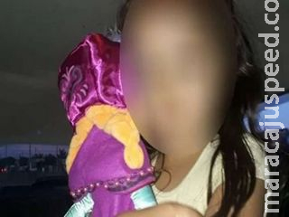 Com bala na nuca, menina que teve nariz dilacerado pelo PCC está na UTI em MS Com bala na nuca, menina que teve nariz dilacerado pelo PCC está na UTI em MS