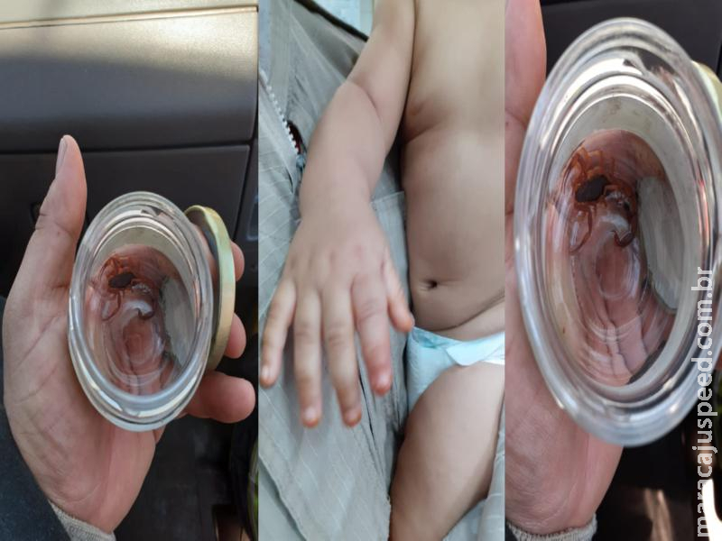 Maracaju: Bebê de apenas 8 meses de vida é picado por escorpião na Vila Adrien. Corpo de Bombeiros realizou socorro do bebê Maracaju: Bebê de apenas 8 meses de vida é picado por escorpião na Vila Adrien. Corpo de Bombeiros realizou socorro do bebê