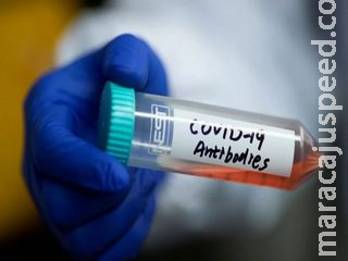 OMC: Pandemia desacelerou medidas comerciais de países do G20 OMC: Pandemia desacelerou medidas comerciais de países do G20