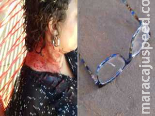 Violência: mulher é empurrada e bate a cabeça no chão durante assalto em Campo Grande