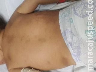 Sob efeito de drogas, pai adolescente deixou bebê cair e estrangulou para acabar com choro, conclui polícia