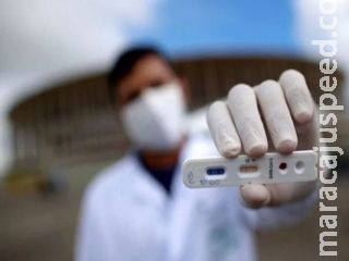 SP confirma primeiro caso de reinfecção por coronavírus do Estado SP confirma primeiro caso de reinfecção por coronavírus do Estado