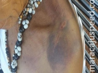 Aldeia denuncia ao MPF casos de tortura após escolha de novo líder em MS Aldeia denuncia ao MPF casos de tortura após escolha de novo líder em MS