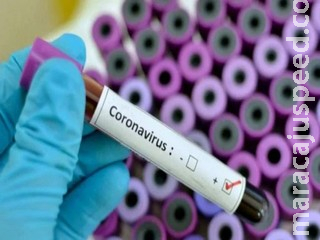 Brasil ultrapassa marca de 195 mil mortes por covid e tem 7,698 milhões de casos Brasil ultrapassa marca de 195 mil mortes por covid e tem 7,698 milhões de casos