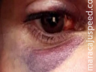 Jovem é derrubada no chão e espancada ao tentar terminar namoro no Carioca