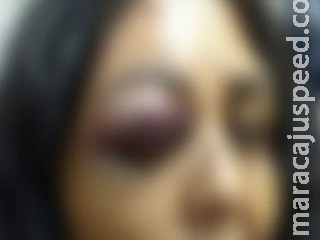 Populares socorrem mulher espancada com chutes nas costas e arrastada por marido na rua Populares socorrem mulher espancada com chutes nas costas e arrastada por marido na rua