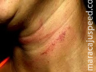 Vizinho salva mulher que foi agredida por marido ao pedir dinheiro para comprar ‘mistura’