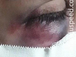Esposa é agredida na frente dos filhos por não ter ‘mistura’ no jantar Esposa é agredida na frente dos filhos por não ter ‘mistura’ no jantar