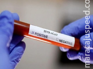São Paulo confirma 25 casos da nova variante brasileira do coronavírus São Paulo confirma 25 casos da nova variante brasileira do coronavírus