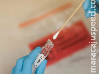 Saúde: Brasil registra 527 mortes por covid-19 em 24h, total chega a 246.504 Saúde: Brasil registra 527 mortes por covid-19 em 24h, total chega a 246.504