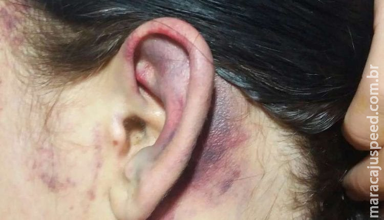 Casada há 18 anos é espancada com cadeira pelo marido e tem roupas jogadas na rua Casada há 18 anos é espancada com cadeira pelo marido e tem roupas jogadas na rua