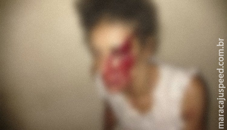 Cliente não paga e garota de programa ainda é espancada por homem em MS Cliente não paga e garota de programa ainda é espancada por homem em MS