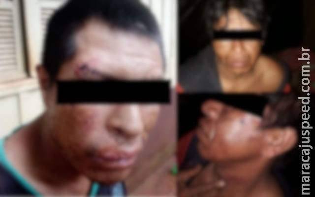 Polícia investiga agressão de suposto grupo armado a indígenas em fazenda de MS Polícia investiga agressão de suposto grupo armado a indígenas em fazenda de MS