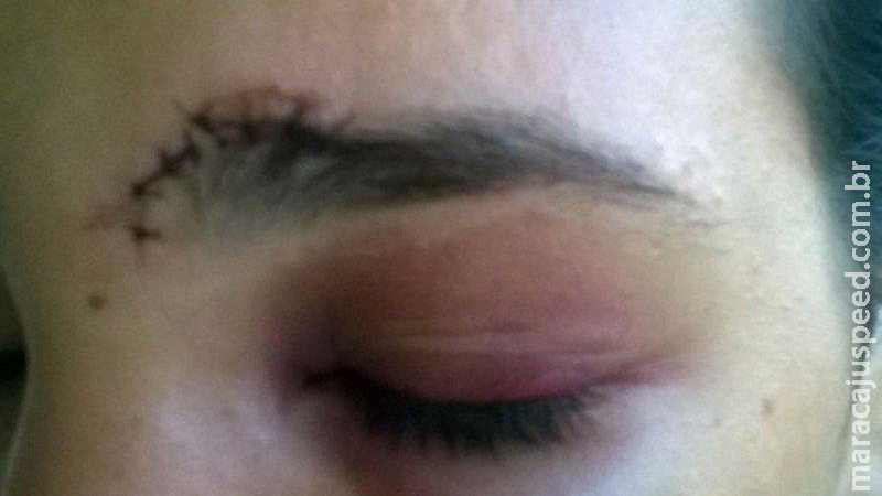 Esposa questiona horário de rapaz e acaba espancada com socos na frente da irmã em MS