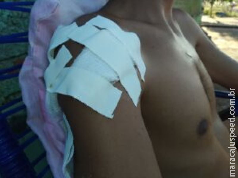  Homem leva 12 facadas após discussão em sua própria casa em Glória de Dourados 