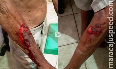  Idoso fica ferido ao ser amarrado e amordaçado em roubo 