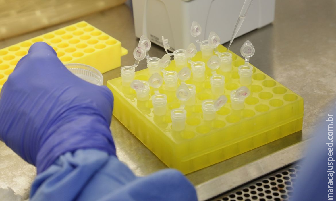Testes para vacina contra HIV têm resultados promissores Testes para vacina contra HIV têm resultados promissores
