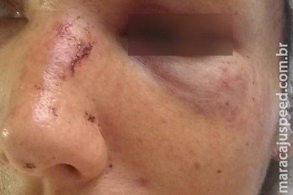 ‘Vou colocar fogo na casa e te matar’: PM é chamada e flagra homem espancando mulher na rua ‘Vou colocar fogo na casa e te matar’: PM é chamada e flagra homem espancando mulher na rua