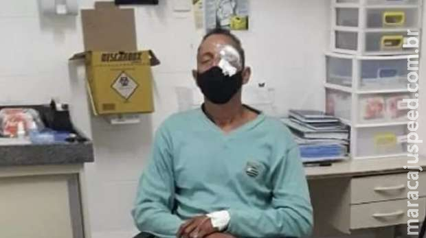 Homem ferido no olho em ação da polícia em protesto no Recife vai processar estado