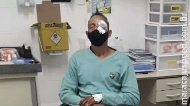 Homem ferido no olho em ação da polícia em protesto no Recife vai processar estado Homem ferido no olho em ação da polícia em protesto no Recife vai processar estado
