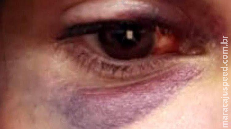 Jovem esfaqueia ex-namorado ao ter casa invadida e ser agredida com socos Jovem esfaqueia ex-namorado ao ter casa invadida e ser agredida com socos