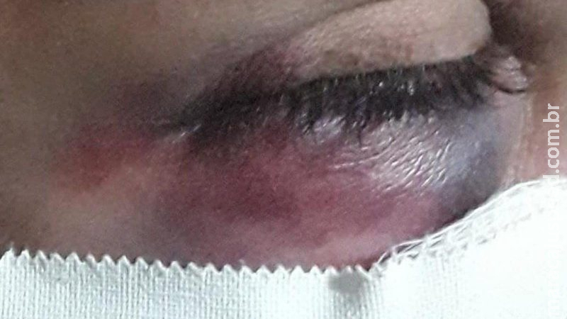 ‘Socorro, ele vai me matar’, mulher é espancada por marido que acaba preso