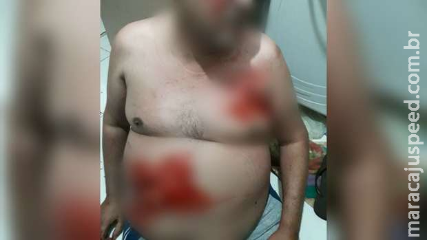 Vídeo: encapuzado que esfaqueou homem revirou apartamento no Nova Lima