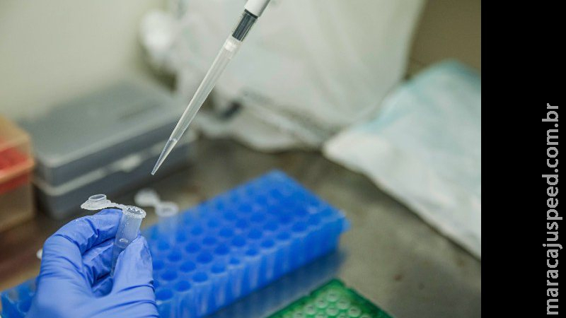 Brasil tem 725 mortes por covid nas últimas 24h, menor registro desde fevereiro Brasil tem 725 mortes por covid nas últimas 24h, menor registro desde fevereiro