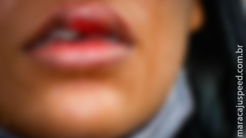 Em MS, genro quebra os dentes e espanca sogra até ela desmaiar Em MS, genro quebra os dentes e espanca sogra até ela desmaiar