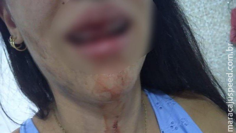 Mulher é espancada até desmaiar e marido diz para PM que ‘caiu’ Mulher é espancada até desmaiar e marido diz para PM que ‘caiu’
