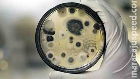 Respirando sem tubos, paciente suspeito de fungo preto de MS já se comunica com equipe de Saúde Respirando sem tubos, paciente suspeito de fungo preto de MS já se comunica com equipe de Saúde