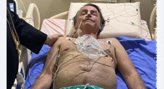 Boletim médico diz que Bolsonaro ficará internado em tratamento clínico e não há necessidade de cirurgia