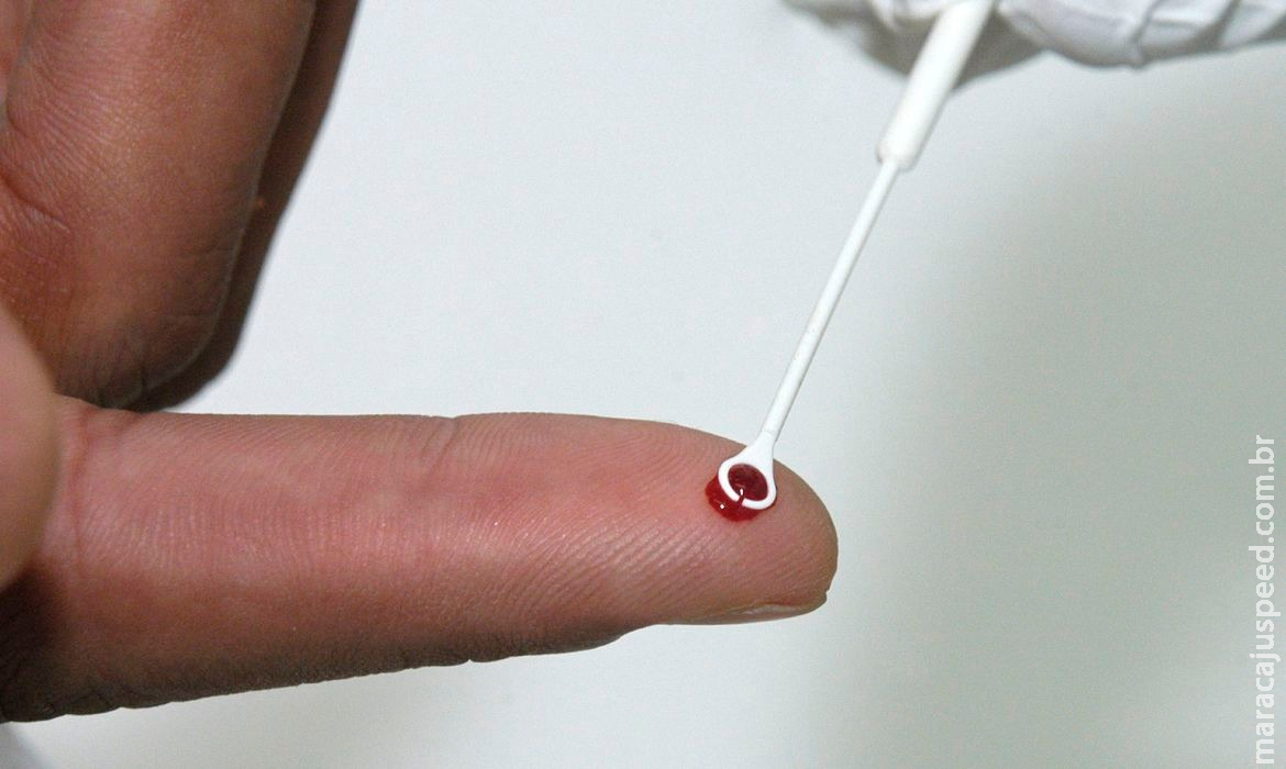 HIV: estudo mostra resistência de mutação a remédio usado no Brasil HIV: estudo mostra resistência de mutação a remédio usado no Brasil