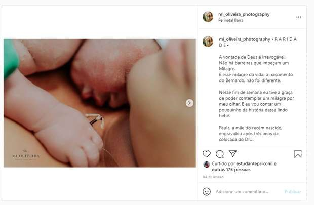 Mãe dá à luz mesmo usando DIU: 