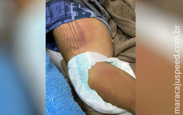 Mãe e padrasto são presos suspeitos de agredir filhos
