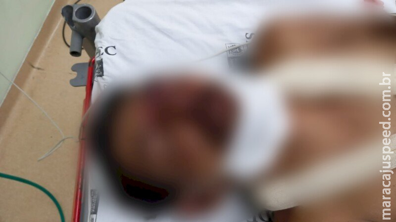 Mulher vai cobrar cliente que fez programa sexual com sua irmã, amigo vai junto e é espancado 