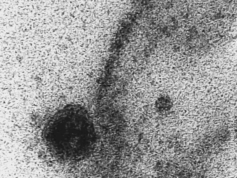 Novo coronavírus infecta e se replica em glândulas salivares Novo coronavírus infecta e se replica em glândulas salivares