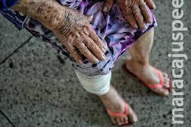 Sogra de 87 anos vai defender nora de ser espancada e acaba agredida a socos e chutes por filho