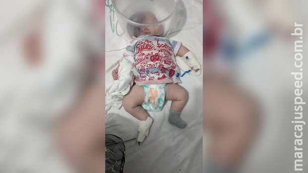 Bebê de 2 meses é internado em estado grave com covid-19 Bebê de 2 meses é internado em estado grave com covid-19